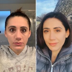 Louise Barnett, now sober